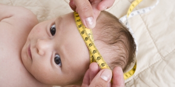 Comprovada a relação entre microcefalia e zika vírus