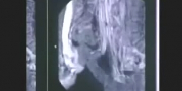 Como é o sexo visto numa máquina de ultrassom 4D