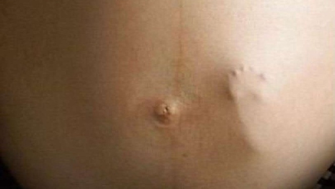 10 Imagens que se passaram por verdadeiras