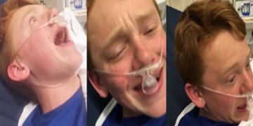 Você precisa ver o vídeo desse garoto acordando da anestesia