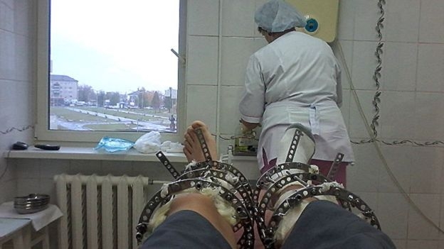 Dor e preço caro: você sabia que é possível ficar mais alto?