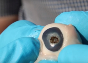 O que acontece se você olhar para o sol por um telescópio