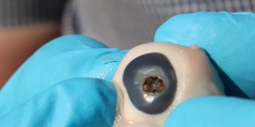 O que acontece se você olhar para o sol por um telescópio