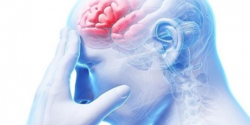 Você sabe o que e Síndrome do Idioma Estrangeiro?