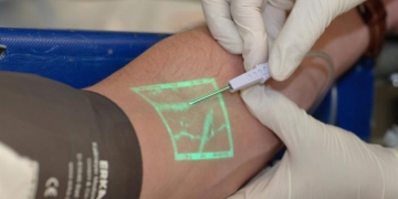 Máquina localiza veia e dispensa múltiplos furos