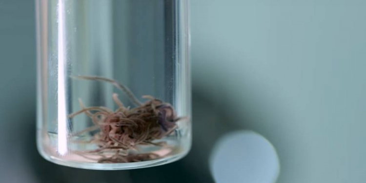 Essas minhocas vivem dentro de uma caverna de enxofre