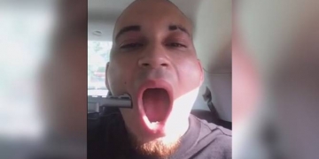 Rapper publica vídeo em que atira na própria bochecha