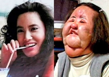 Essa mulher aplicou óleo de cozinha no rosto