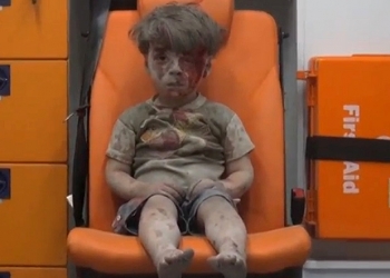 Menino Sírio salvo de escombros chama atenção mundial