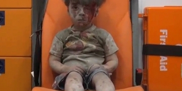 Menino Sírio salvo de escombros chama atenção mundial