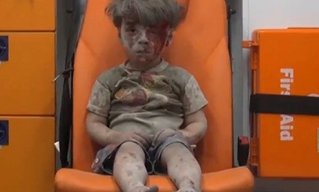 Menino Sírio salvo de escombros chama atenção mundial