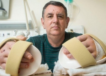 1º paciente de transplante de mãos se arrepende