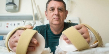1º paciente de transplante de mãos se arrepende