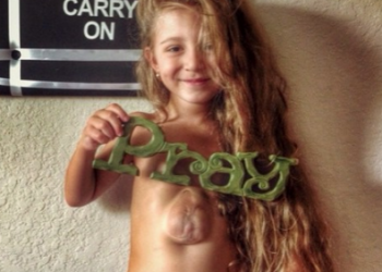 Essa menina nasceu com o coração exposto