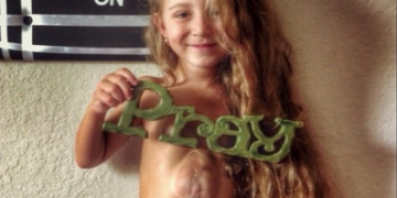 Essa menina nasceu com o coração exposto