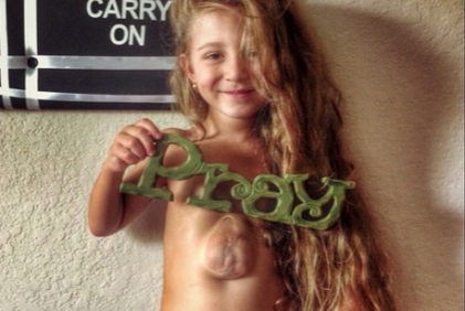 Essa menina nasceu com o coração exposto