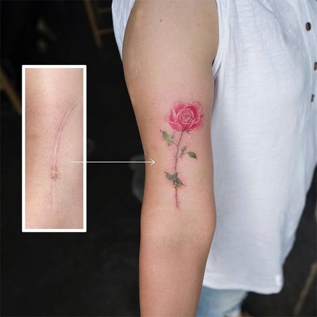 cicatriz-tatuagem11