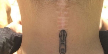 16 pessoas que abraçaram suas cicatrizes na hora de fazer uma tatuagem