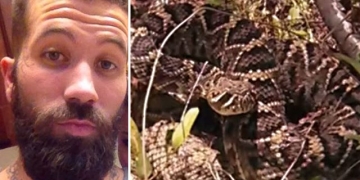 O que esse cara passou deixa a lição: não tente beijar uma cascavel