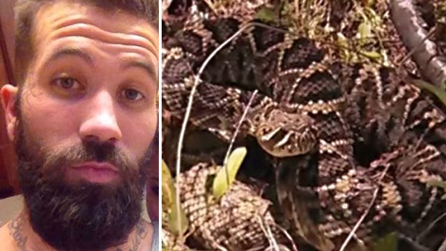 O que esse cara passou deixa a lição: não tente beijar uma cascavel