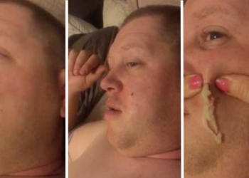 Que nojo! Mulher espreme cravo de quatro anos no rosto do marido