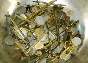 Médicos removem 7 kg de metais do estômago de homem indiano