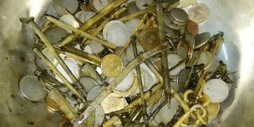 Médicos removem 7 kg de metais do estômago de homem indiano