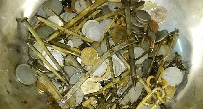 Médicos removem 7 kg de metais do estômago de homem indiano