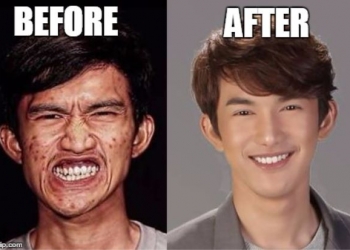 A cirurgia desse cara é tão impressionante que confundiu a própria mãe