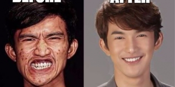 A cirurgia desse cara é tão impressionante que confundiu a própria mãe