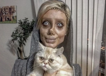 Jovem se submete a mais de 50 cirurgias para ter rosto da Angelina Jolie