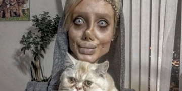 Jovem se submete a mais de 50 cirurgias para ter rosto da Angelina Jolie