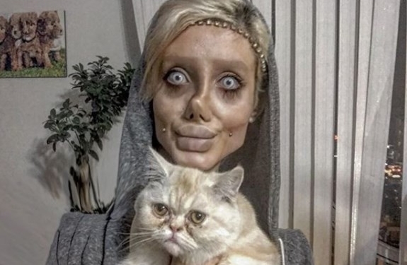 Jovem se submete a mais de 50 cirurgias para ter rosto da Angelina Jolie