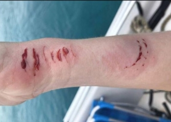 Homem filma mulher sendo atacada por tubarão na lua-de-mel