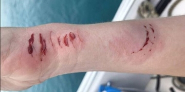 Homem filma mulher sendo atacada por tubarão na lua-de-mel