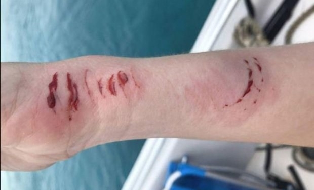 Homem filma mulher sendo atacada por tubarão na lua-de-mel