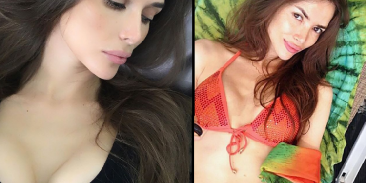 Blogueira russa fica com seios ‘quadrados’ depois de implante