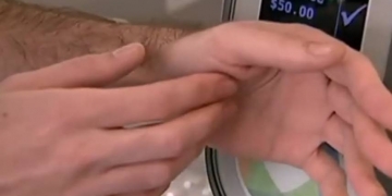 Australiano implanta chip de transporte coletivo no próprio braço