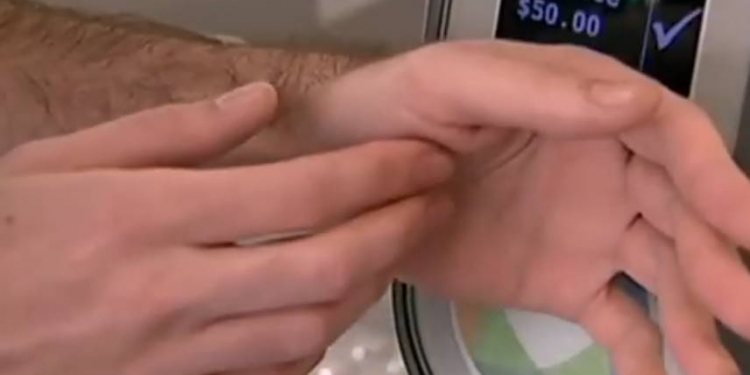 Australiano implanta chip de transporte coletivo no próprio braço