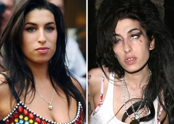 Antes e Depois de Celebridades após Uso das Drogas