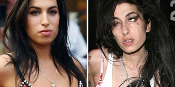 Antes e Depois de Celebridades após Uso das Drogas